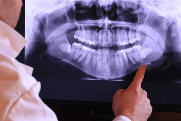 Best Orthodontic Emergency Dentist in Baldn, WI
